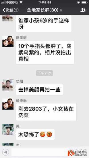 长沙6岁女童疑遭虐待满身伤痕头骨凹凸 其母被刑拘